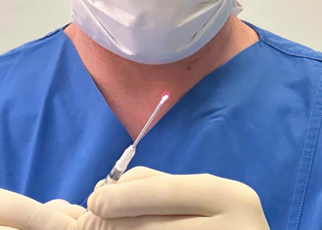 Dioden Laser zur Operation bei Analfistel